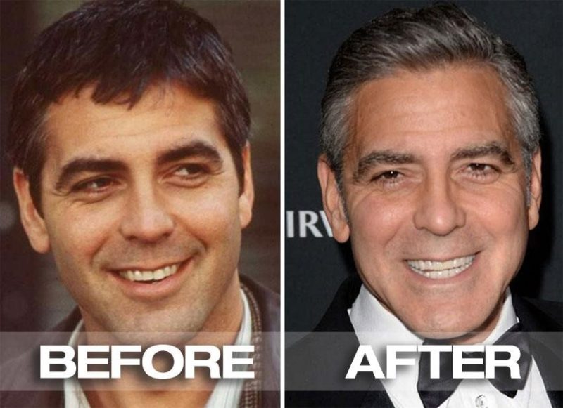 15 Celebrities Who Had To Go Through Cosmetic Dentistry & Now Have New Teeth