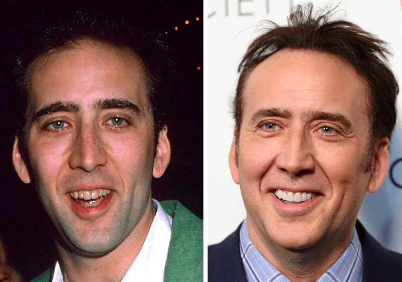 15 Celebrities Who Had To Go Through Cosmetic Dentistry & Now Have New Teeth