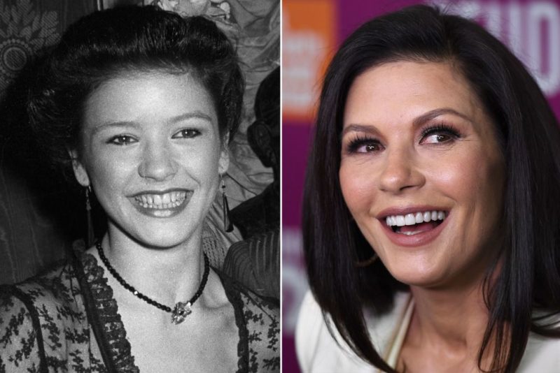 15 Celebrities Who Had To Go Through Cosmetic Dentistry & Now Have New Teeth