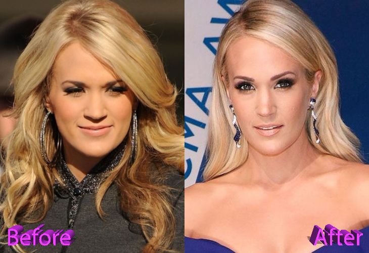 11 Hollywood Celebrities Whose Weight Loss Journey Set Fitness Goals