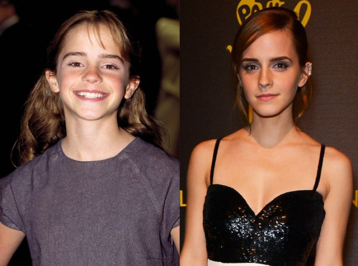 15 Before and after the photos of child stars that turned out to be perfect